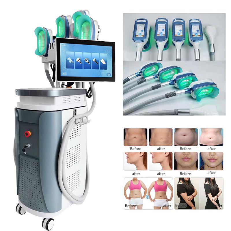 Medical CE Vertical Fat-Freeze Multi-system